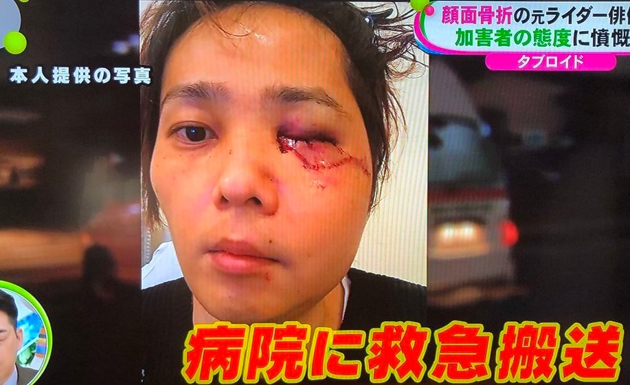 大けがを負った椿隆之の顔写真